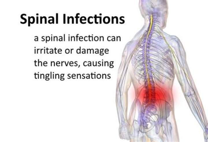 Can cancer cause tingling back?