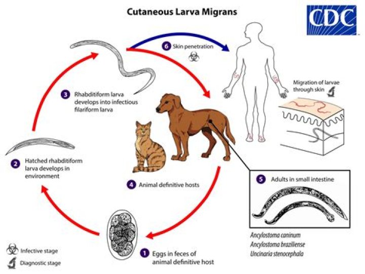 Can humans get ancylostoma Caninum?