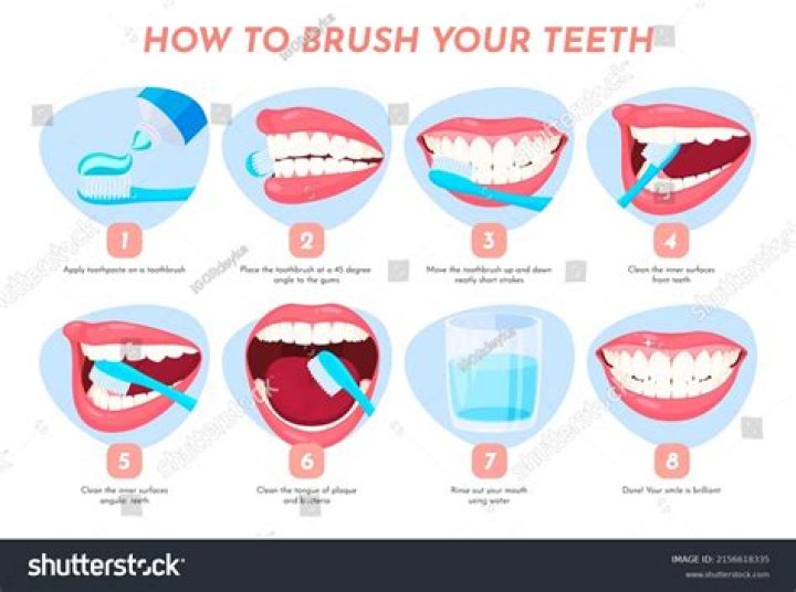 Can I brush my teeth after bleaching?