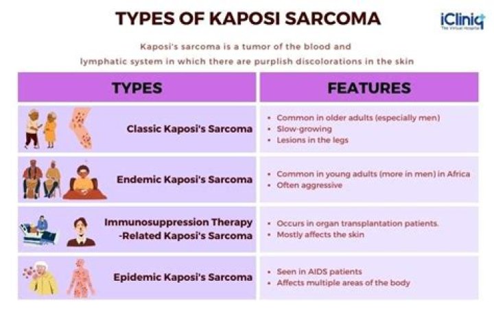 Can sarcoma in the lungs be cured?