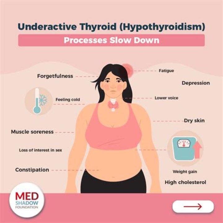 Can thyroid problems cause hyponatremia?