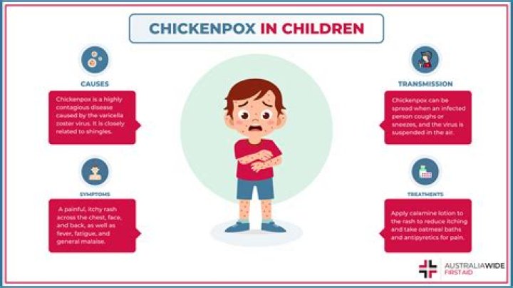 Can you be a chicken pox carrier?