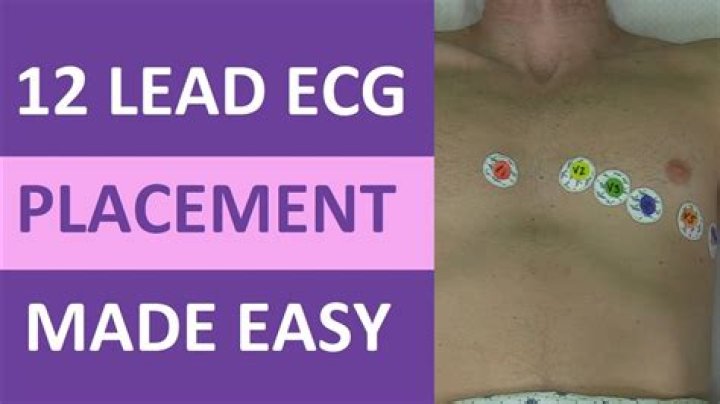 Can you do a 12-lead ECG at home?