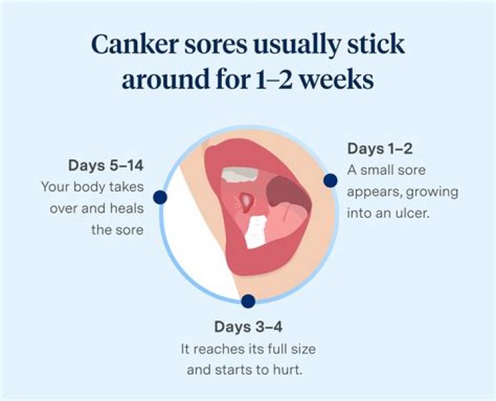 Can you get a canker sore near your tooth?