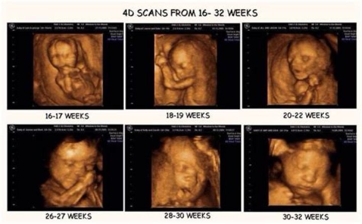Can you have a 4D scan at 22 weeks?