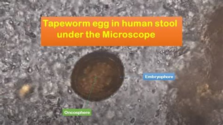 Can you see worm eggs in human stool?