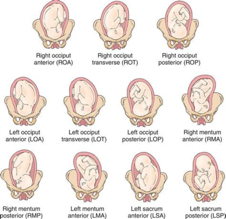 Can you tell baby position by heartbeat?