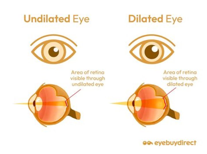 Can your eyes stay permanently dilated?