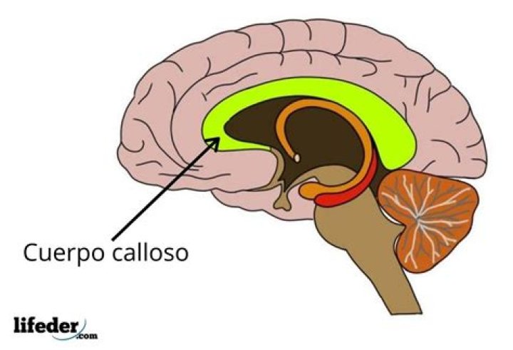 Cosa e il corpo calloso?