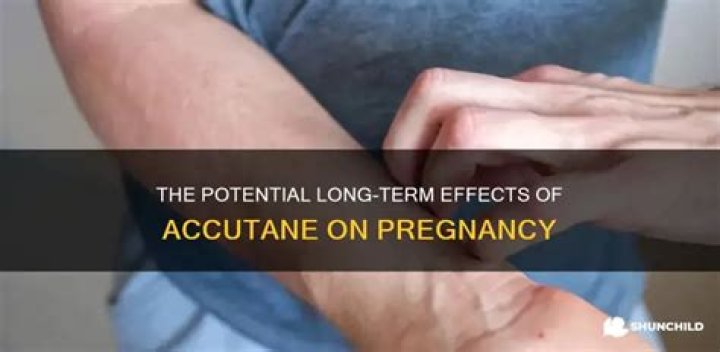 Does Accutane have long-term effects on pregnancy?