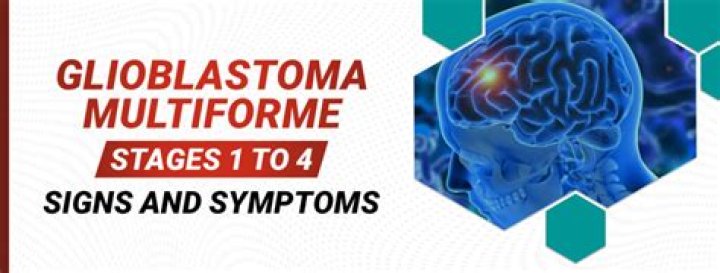 Does anyone survive stage 4 glioblastoma?