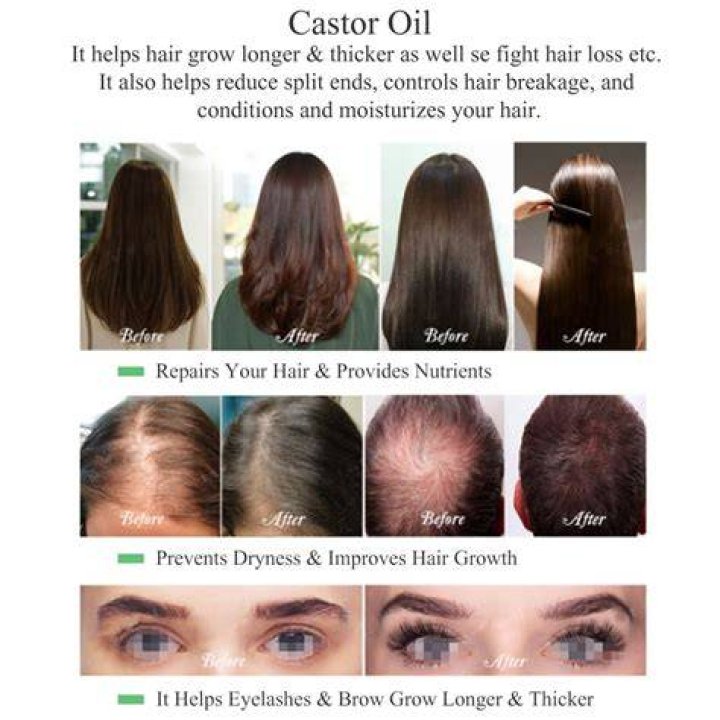 Does castor oil help hair grow?