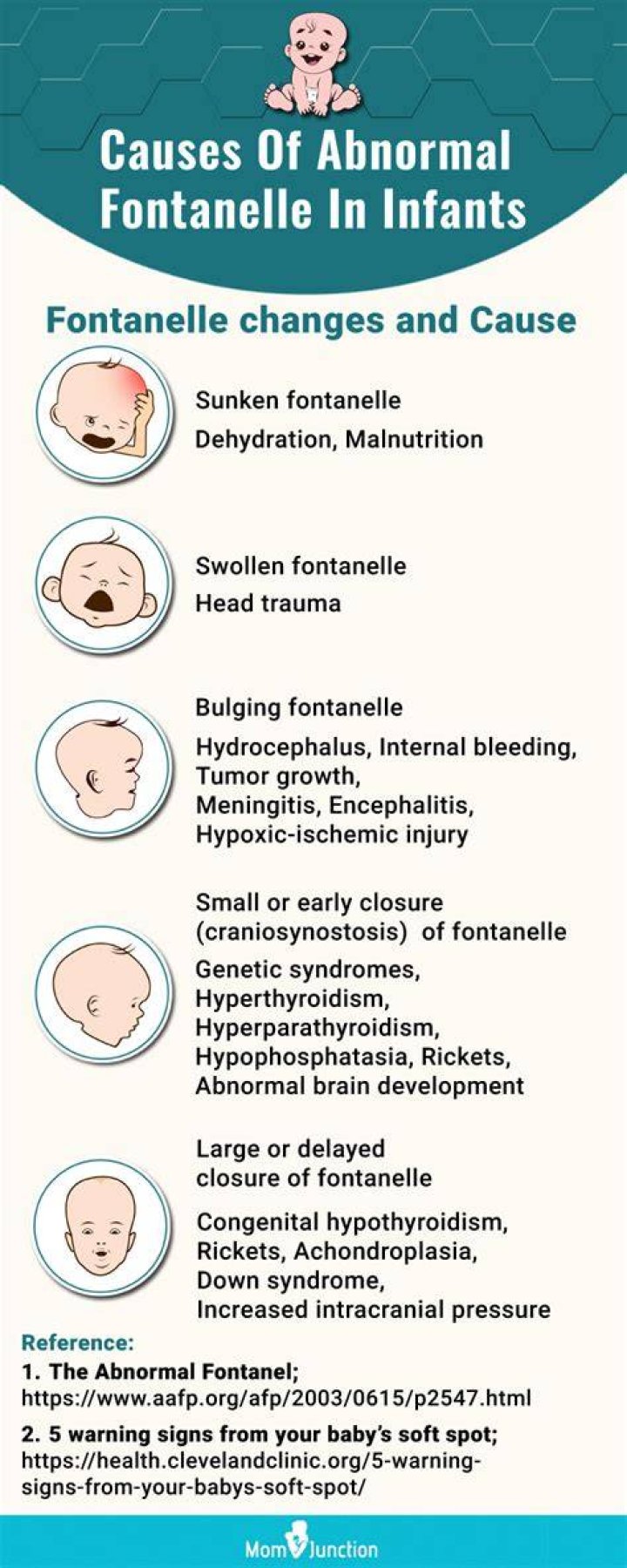 Does dehydration cause bulging fontanelle?