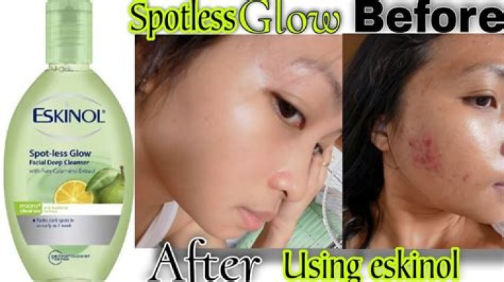 Does Eskinol remove dark spots?