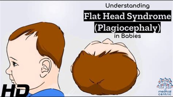 Does Flat Head correct itself?
