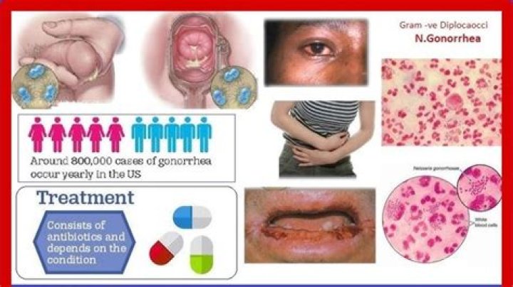Does gonorrhea produce beta lactamase?