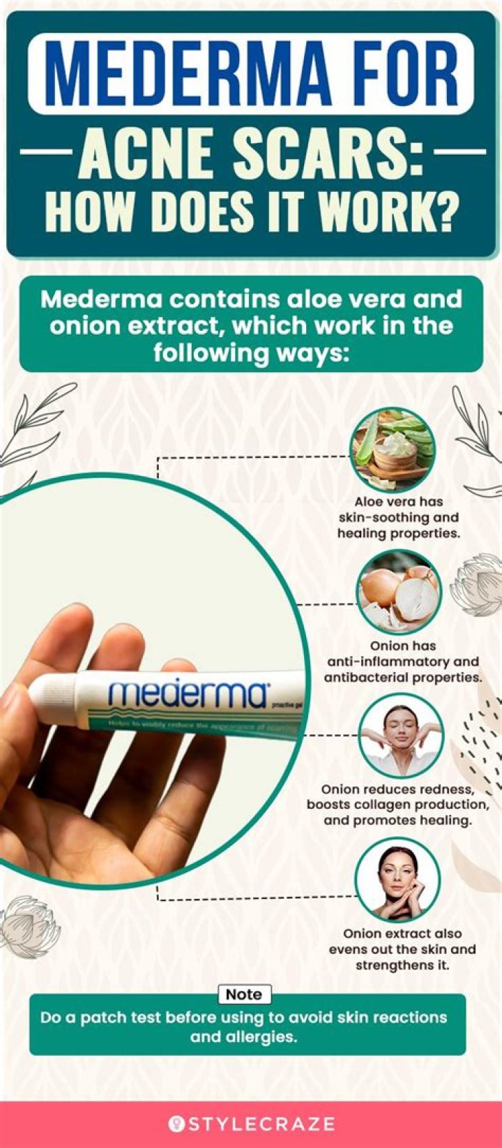 Does Mederma work on 10 year old scars?
