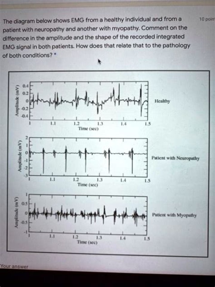 Does myopathy show on EMG?