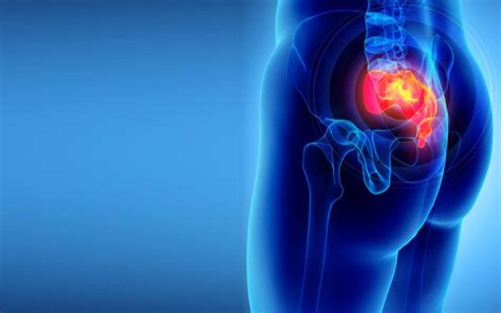 Does pilonidal cyst cause bleeding?