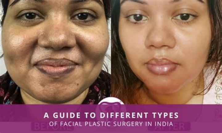 Does plastic surgery make your face puffy?
