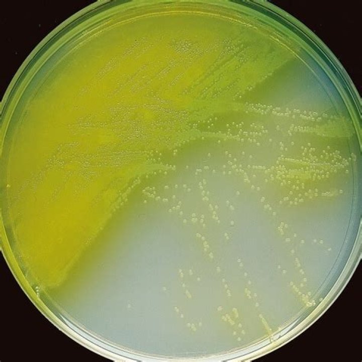 Does Pseudomonas aeruginosa grow on Cetrimide Agar?