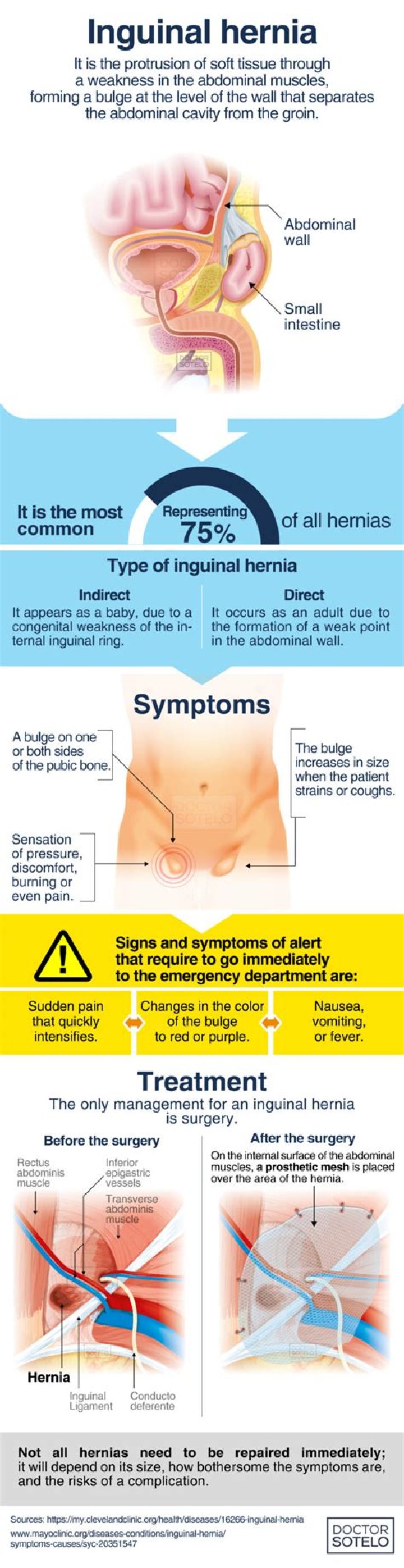 How bad is an inguinal hernia?