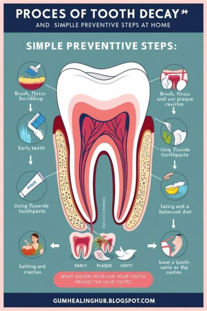 How can I permanently treat tooth decay at home?