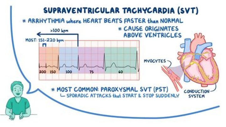 How can you tell the difference between supraventricular tachycardia and ventricular tachycardia?