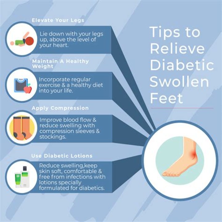 How do diabetics get rid of swollen feet?