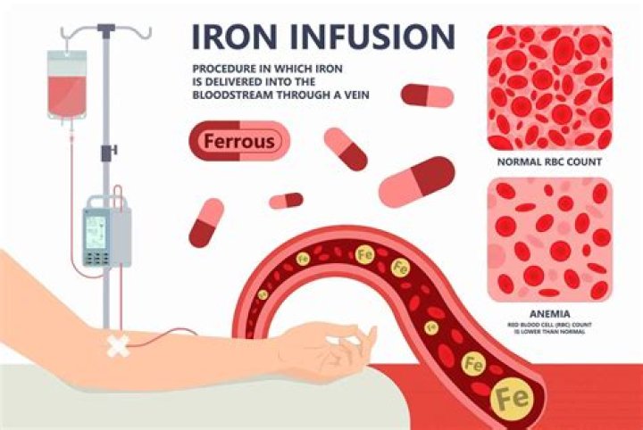 How do doctors treat iron overload?