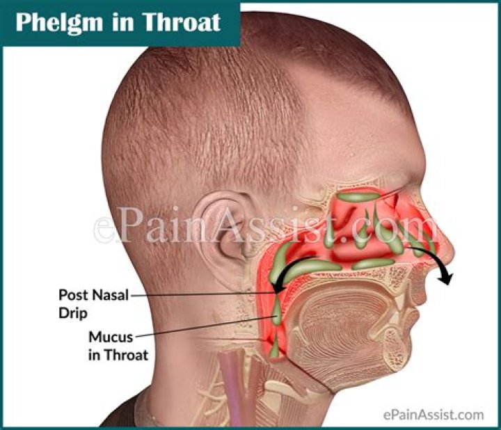 How do I get rid of phlegm in the back of my throat?