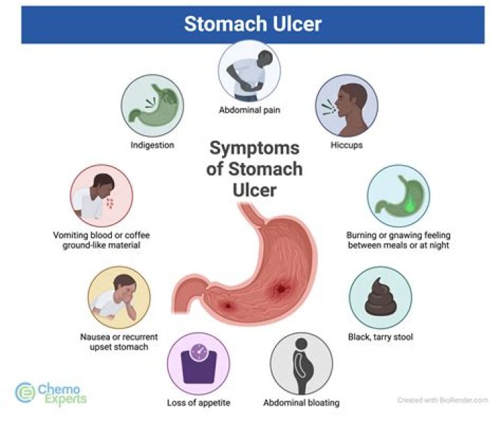 How do I know if I have an ulcer in my stomach?