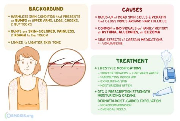 How do I stop itching from keratosis pilaris?