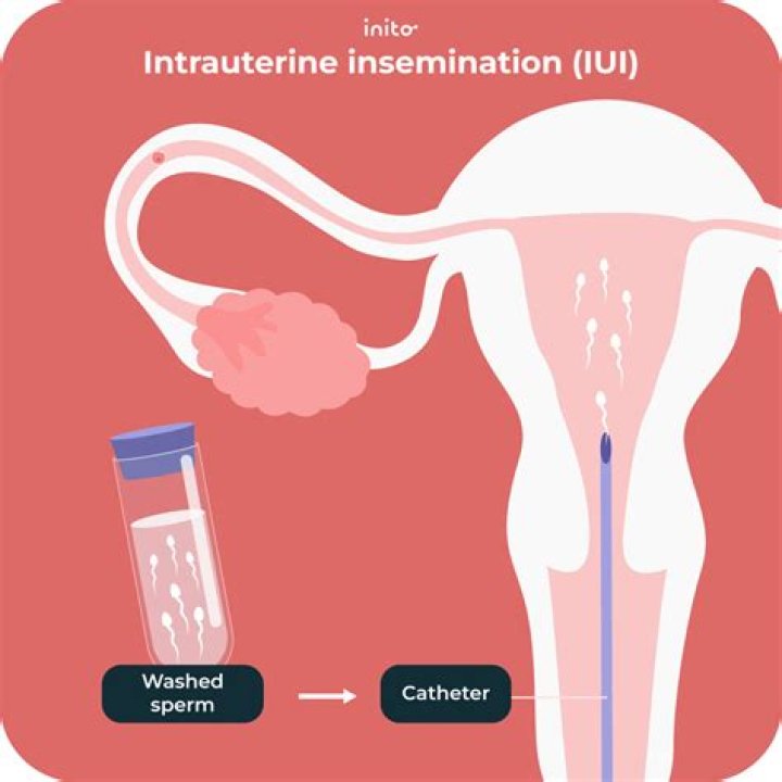 How do you do intrauterine resuscitation?