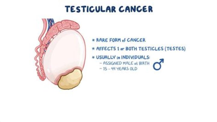 How do you feel when you have cancer in your balls?