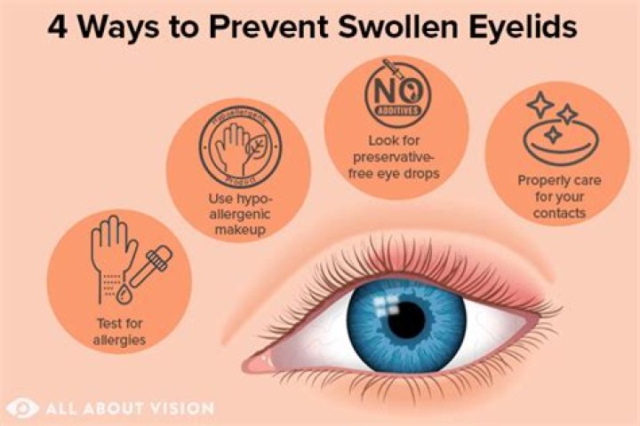 How do you make morning eye swelling go down?