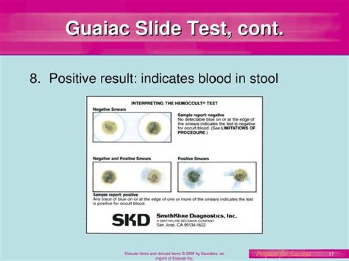 How do you perform a guaiac test?