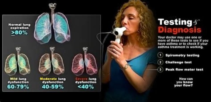 How do you test for aspirin toxicity?