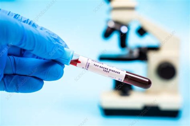 How do you test for Tay-Sachs gene?