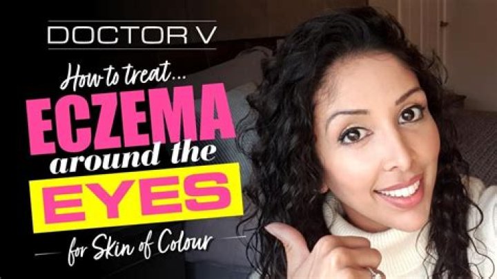 How do you treat eczema around the eyes?