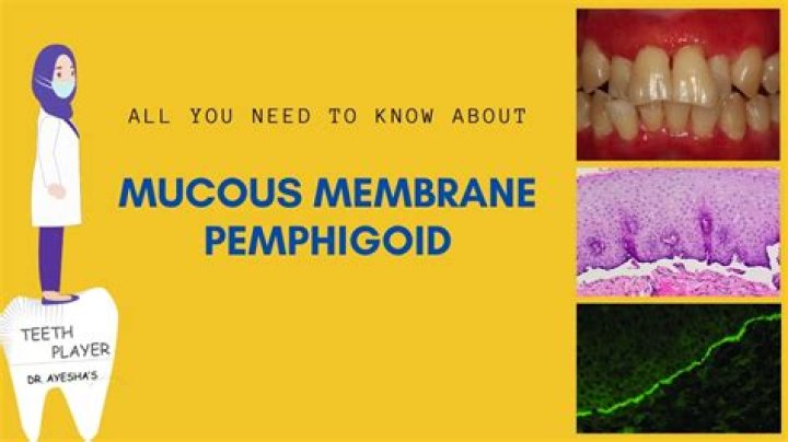 How do you treat inflamed mucous membranes?