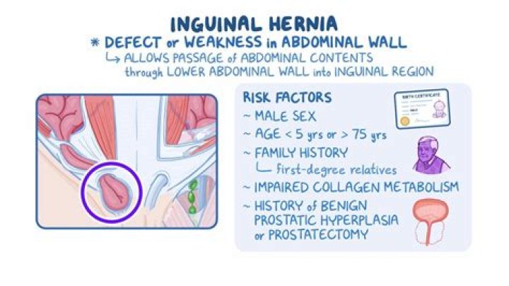How does inguinal hernia develop 12?
