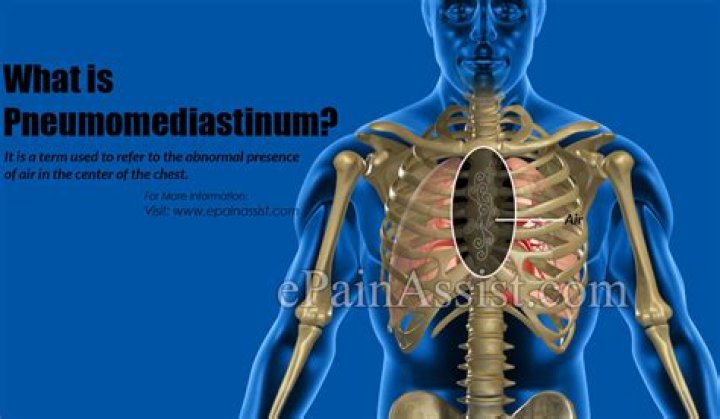 How does pneumomediastinum occur?