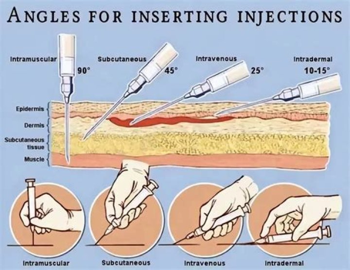How is diclofenac injection given?