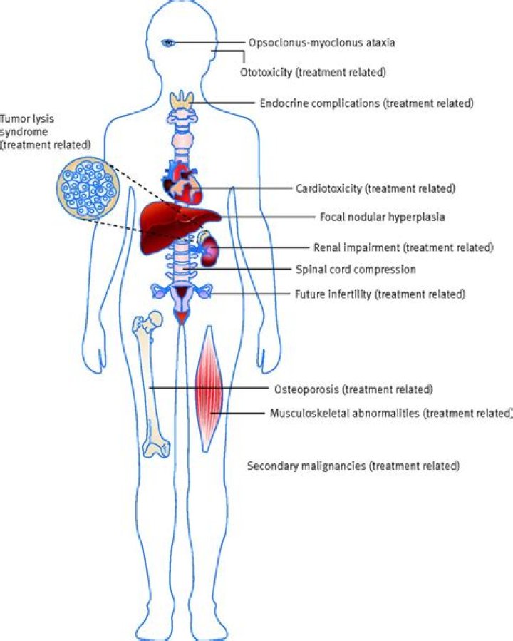 How is neuroblastoma diagnosed in adults?
