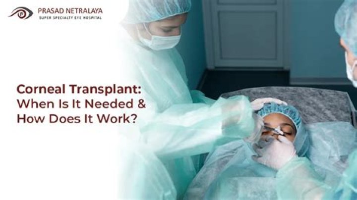How long can one expect for a corneal transplant to last?