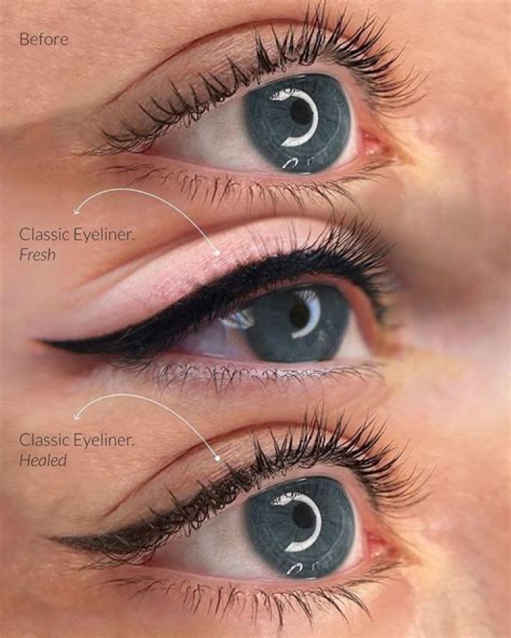 How long does it take for eyeliner tattoo to heal?
