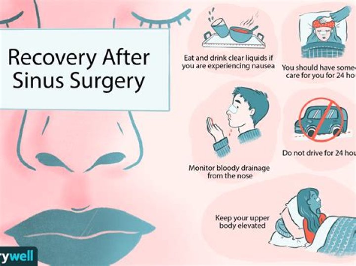 How long does it take to recover from sphenoid sinus surgery?