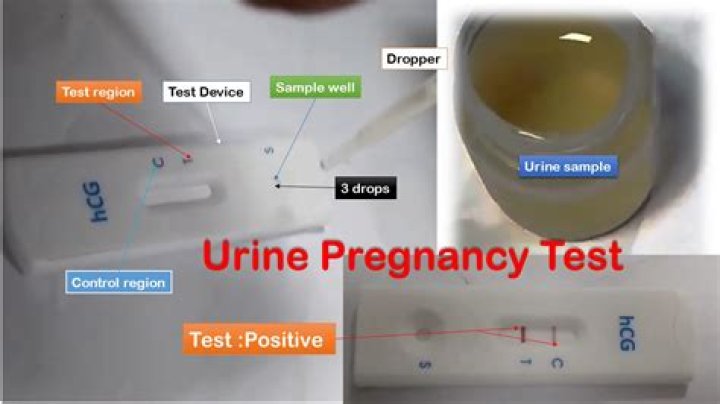How long does urine pregnancy test stay positive after miscarriage?