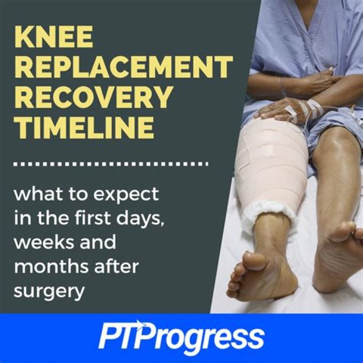 How long is recovery from big toe surgery?